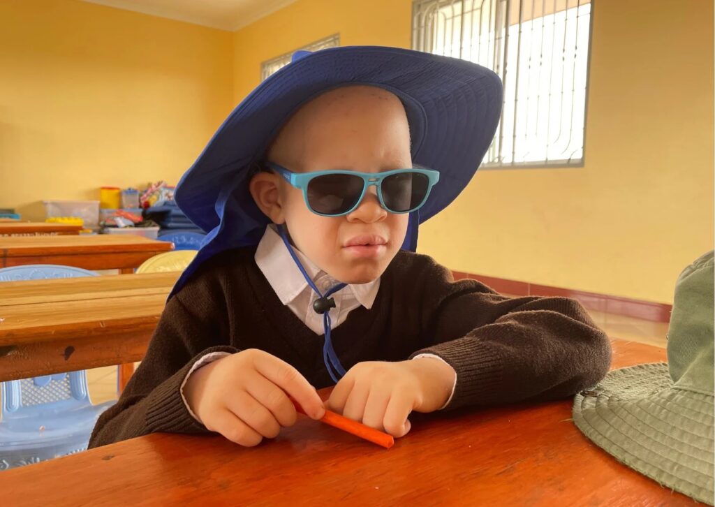 A child with albinism wearing a blue sunhat and sunglasses, sitting at a desk.