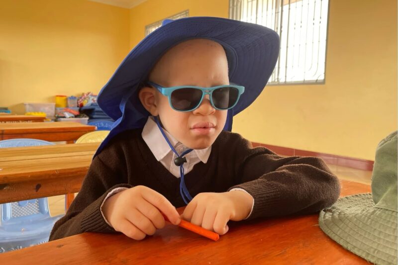 A child with albinism wearing a blue sunhat and sunglasses, sitting at a desk.