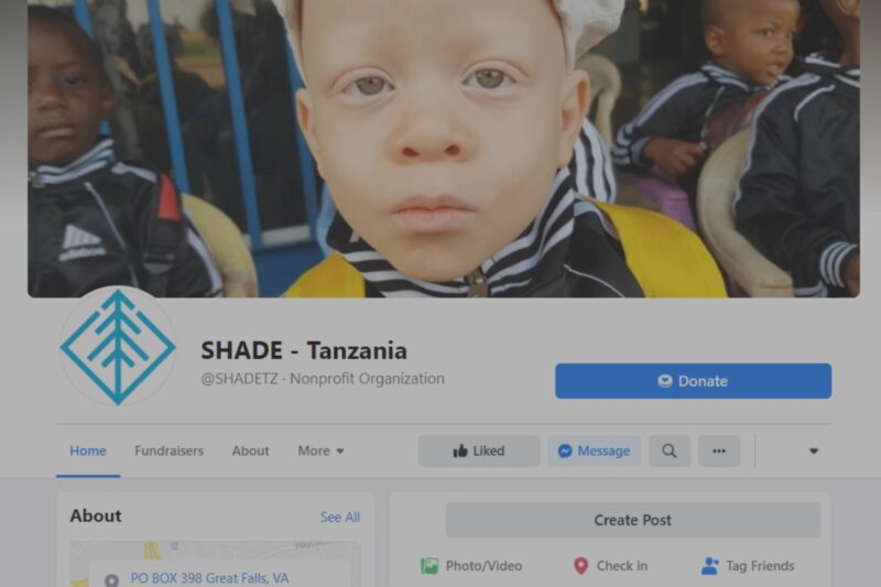 Child with albinism from SHADE - Tanzania organization.