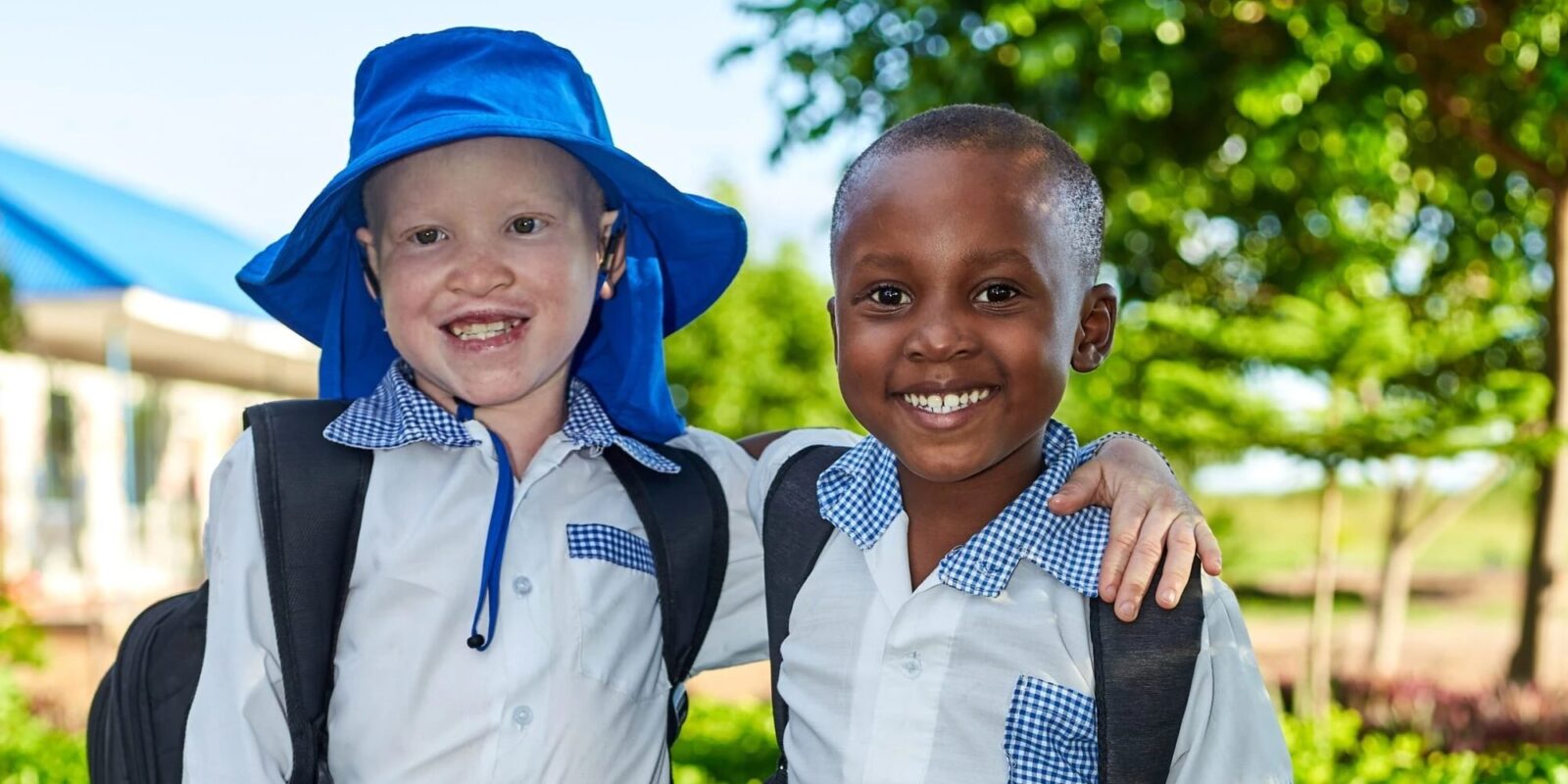 Two school children, one with albinism, smiling and standing with arms around each other.